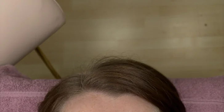 Missi Beauty Studio: Plasmalifting alebo darčeková poukážka