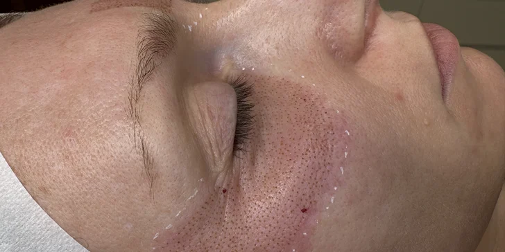 Missi Beauty Studio: Plasmalifting alebo darčeková poukážka