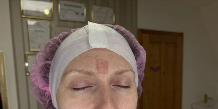 Missi Beauty Studio: Plasmalifting alebo darčeková poukážka