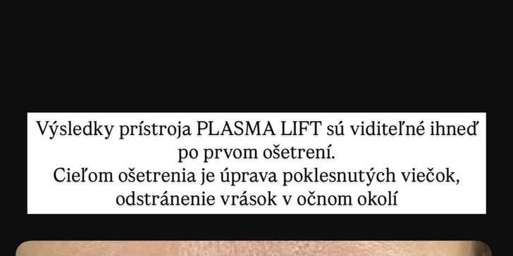 Čistenie pleti s chemickým peelingom, mezoterapia či plazmalifting