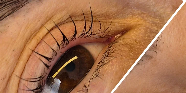 Syntetické mihalnice, lash lift alebo laminácia obočia