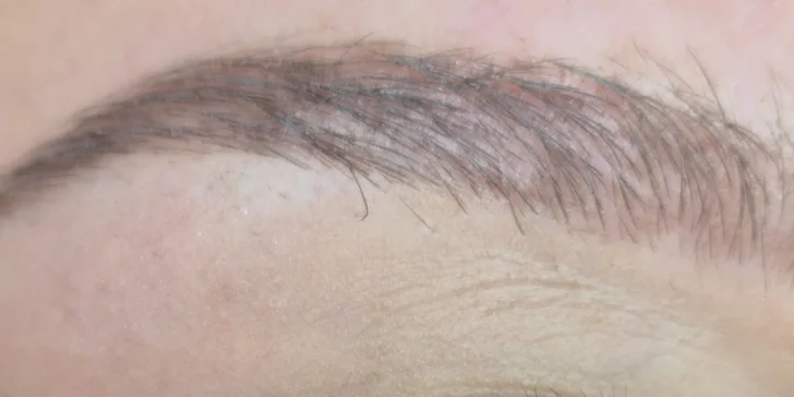 Syntetické mihalnice, lash lift alebo laminácia obočia