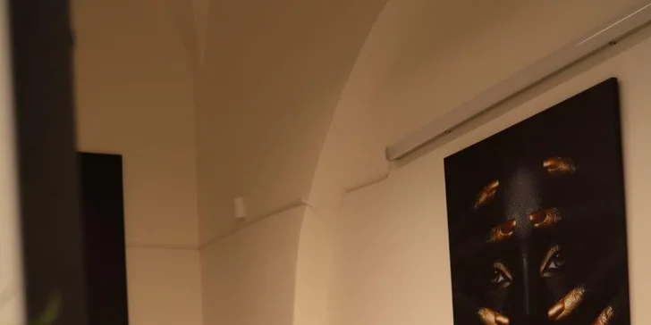 Laserové epilácia rôznych partií: Zbavte sa chĺpkov navždy