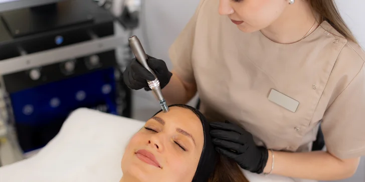 Mikroihličkovanie pleti prístrojom SkinPen s omladzujúcim efektom