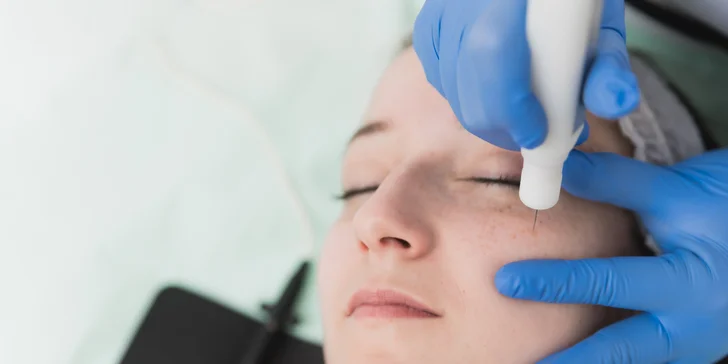 Missi Beauty Studio: Plasmalifting alebo darčeková poukážka