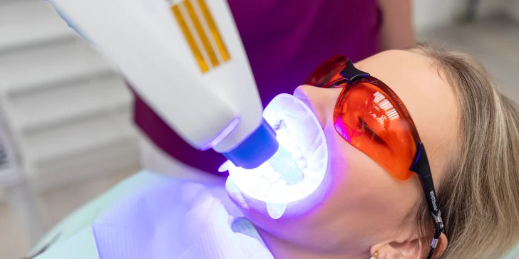 Profesionálne bielenie zubov Opalescence s dentálnou hygienou