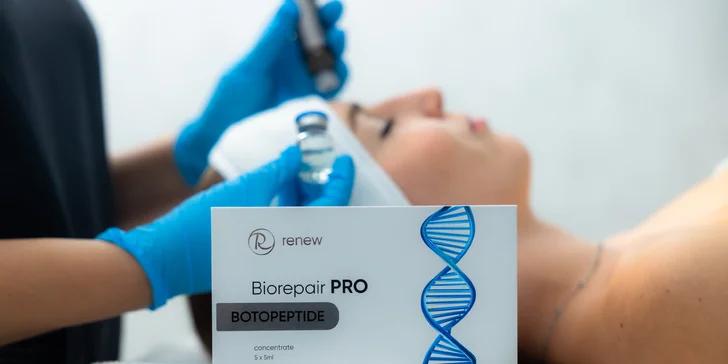 Kozmetické ošetrenia na omladenie pleti: Kolagénové nite, Carboxyterapia alebo mezopeeling