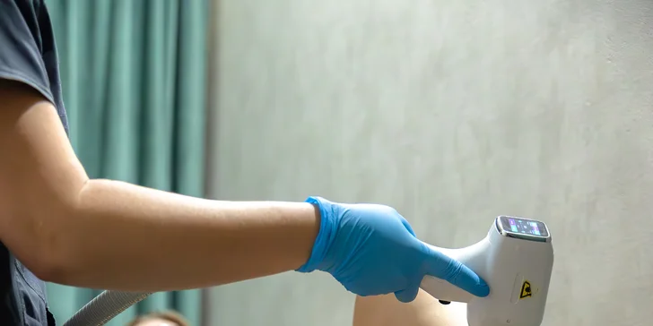 Epilácia vybraných častí tela diódovým vysokofrekvenčným laserom