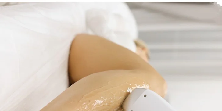 Laserová epilácia - hladká pokožka bez kompromisov