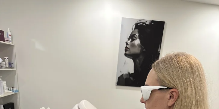 Laserová epilácia - hladká pokožka bez kompromisov