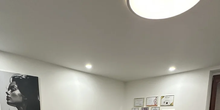 Laserová epilácia - hladká pokožka bez kompromisov