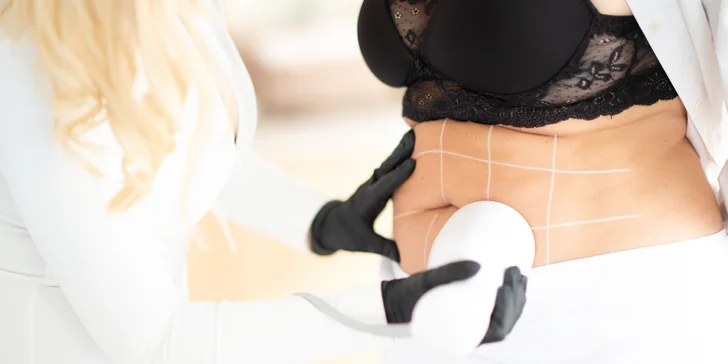 Mladistvý vzhľad pomocou HIFU 7D terapie - neinvazívny lifting celej tváre alebo zoštíhlenie pomocou HIFU LIPOSONIX