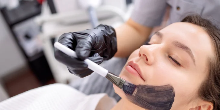 Kozmetické ošetrenia pre čistú a mladistvú pleť: Hollywood Carbon Peel tváre a krku alebo rádiofrekvencia s kompletným čístením pleti