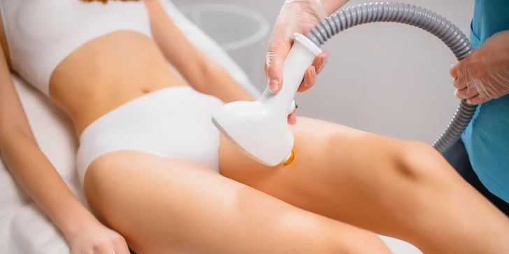 Laserová epilácia - hladká pokožka bez kompromisov