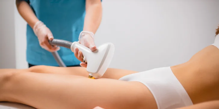 Laserová epilácia - hladká pokožka bez kompromisov