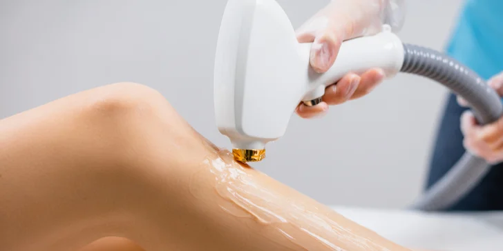 Laserová epilácia - hladká pokožka bez kompromisov