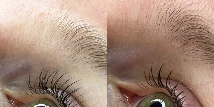 Lash lifting, laminácia obočia alebo výhodné kombo