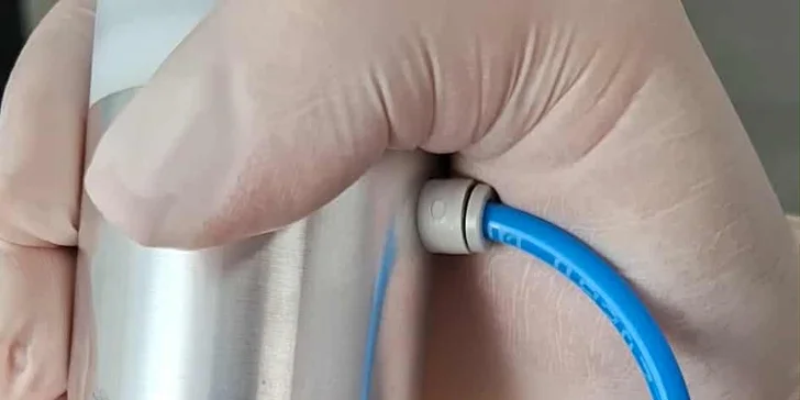 Neinvazívny facelifting pomocou mikroihličkovej frakčnej (MF) rádiofrekvencie: okolie očí, čelo alebo celá tvár