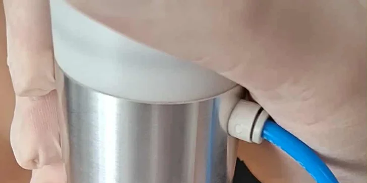 Neinvazívny facelifting pomocou mikroihličkovej frakčnej (MF) rádiofrekvencie: okolie očí, čelo alebo celá tvár