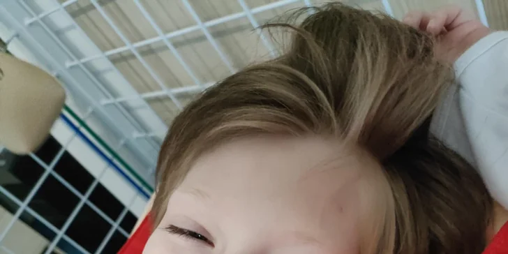 Kamilka s Dravetovej syndrómom: Po dvoch operáciách chce urobiť svoj prvý krok – buďte súčasťou jej cesty!