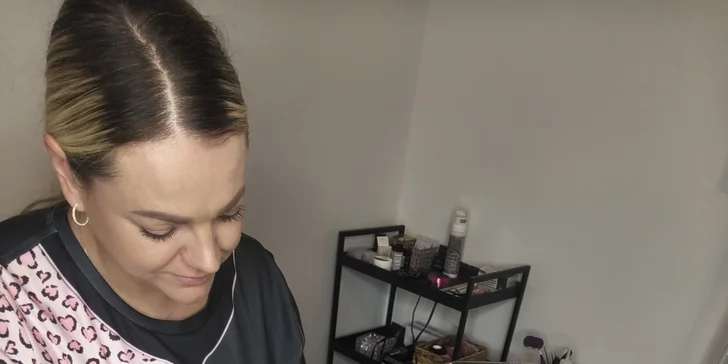 Pleťové ošetrenia LARENS: hĺbkové čistenie pleti alebo chemický peeling