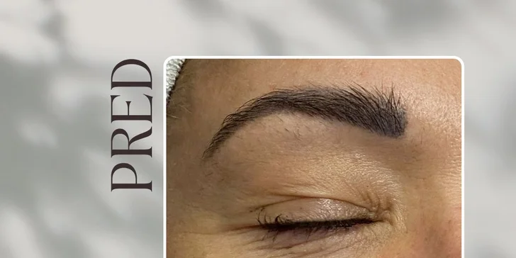 Ošetrenie s exozómami pre rozjasnenú a spevnenú pleť