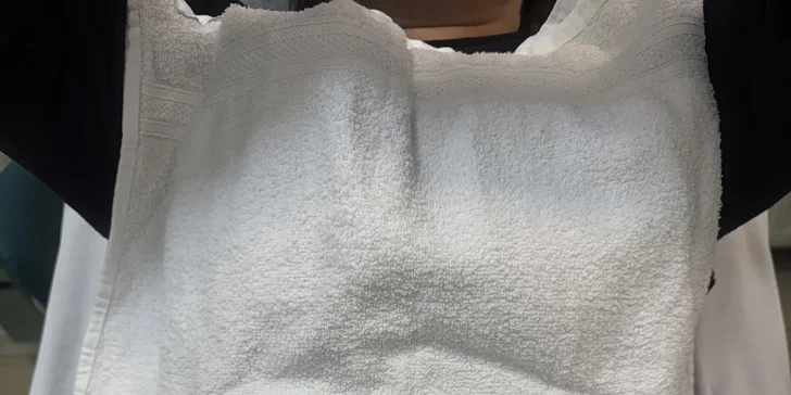 Formovanie postavy a redukcia tukových zásob pomocou kontrolovaného ochladenia