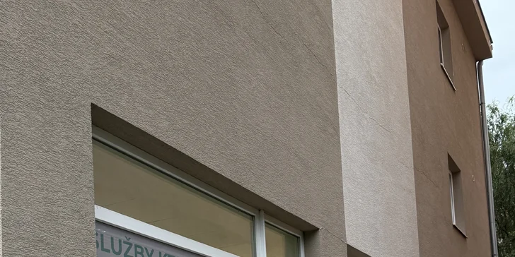 7D HIFU ošetrenie tváre, krku aj dekoltu