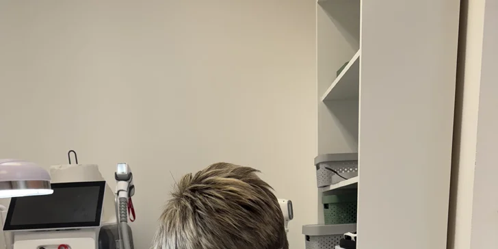 Elektroepilácia: trvalé odstránenie chĺpkov, aj výhodné permanentky