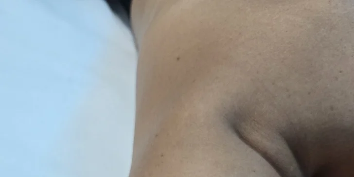 Individuálne alebo párové škrabkanie celého tela, hlavy aj šije