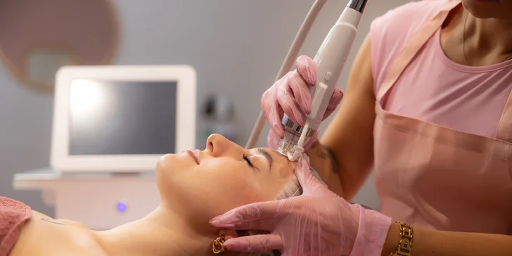 RF mikroihličkovanie – frakčná rádiofrekvencia: neinvazívne omladzujúce ošetrenia