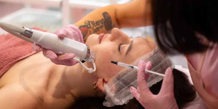 RF mikroihličkovanie – frakčná rádiofrekvencia: neinvazívne omladzujúce ošetrenia