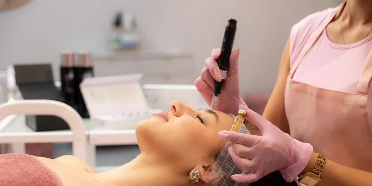 Mikroihličková mezoterapia Dermapen – lifting a omladenie s peptidmi, PDRN či exozómami