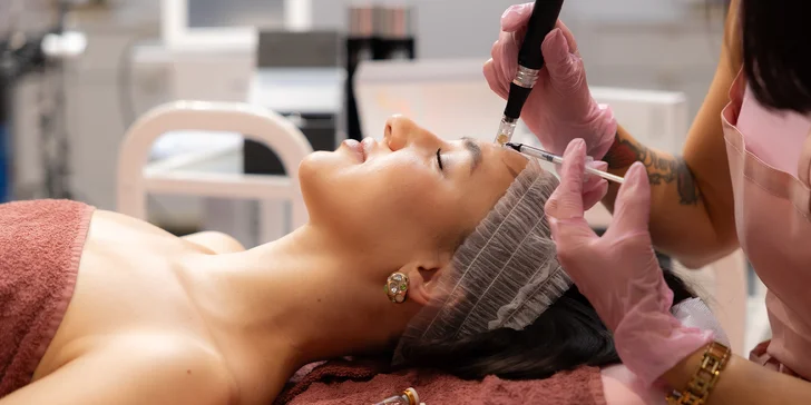 Mikroihličková mezoterapia Dermapen – lifting a omladenie s peptidmi, PDRN či exozómami