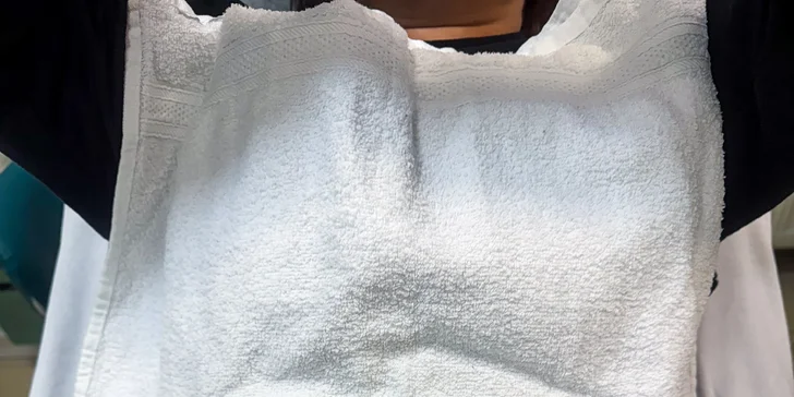 7D HIFU ošetrenie tváre, krku aj dekoltu