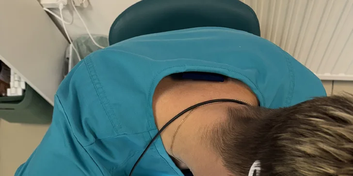 Elektroepilácia: trvalé odstránenie chĺpkov, aj výhodné permanentky