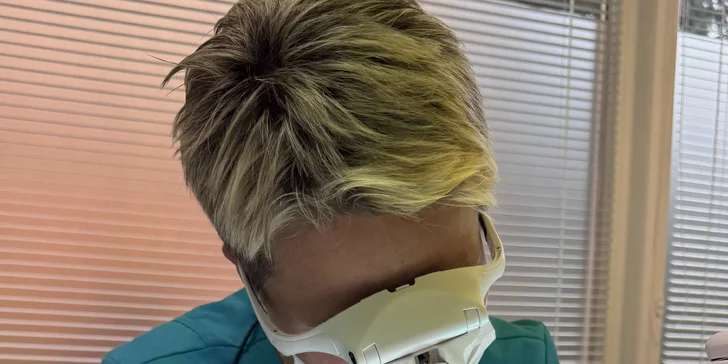 Elektroepilácia: trvalé odstránenie chĺpkov, aj výhodné permanentky