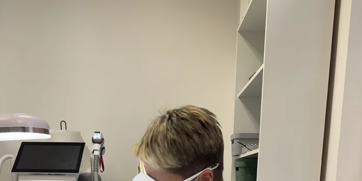 Elektroepilácia: trvalé odstránenie chĺpkov, aj výhodné permanentky