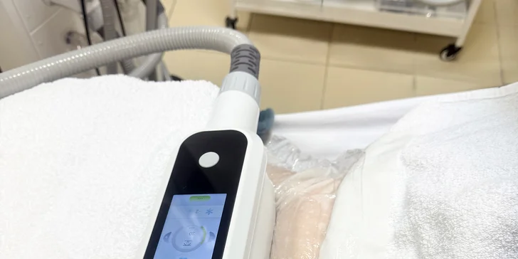 Formovanie postavy a redukcia tukových zásob pomocou kontrolovaného ochladenia