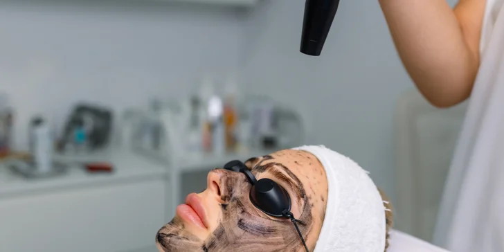 Komplexné ošetrenie HOLLYWOOD CARBON PEEL, aj permanentka na 4 ošetrenia