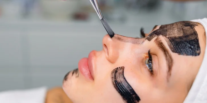 Komplexné ošetrenie HOLLYWOOD CARBON PEEL, aj permanentka na 4 ošetrenia