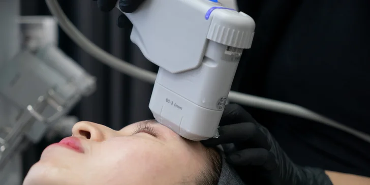 HIFU 12D ošetrenie: spevnená pleť a zvýraznené kontúry tváre