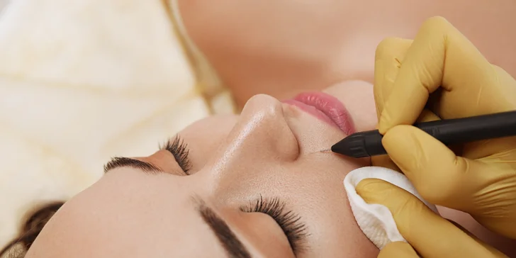 Odstránenie cievnych sietí a metličkových žiliek vysokorádiovou ihlo, RF koagulácia