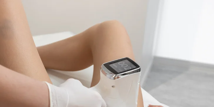 Laserová epilácia diódovým laserom Alfa Pro 2 pre dámy aj pánov
