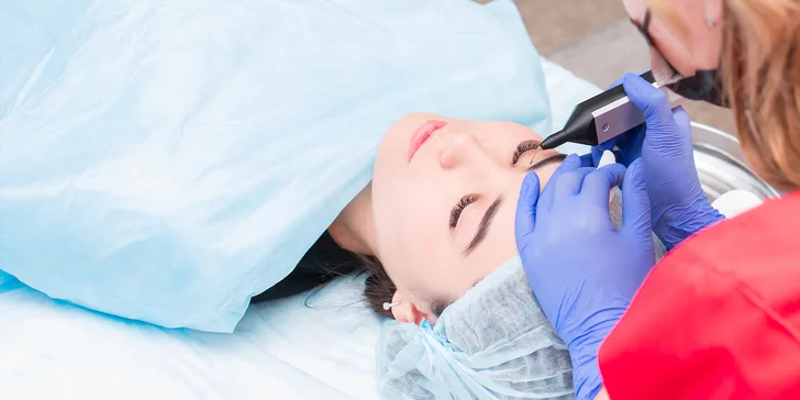 Plazmalift: horné alebo dolné viečka, vrásky okolo očí, celé čelo, nosoústna vráska