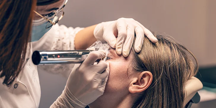 Plazmalift: horné alebo dolné viečka, vrásky okolo očí, celé čelo, nosoústna vráska