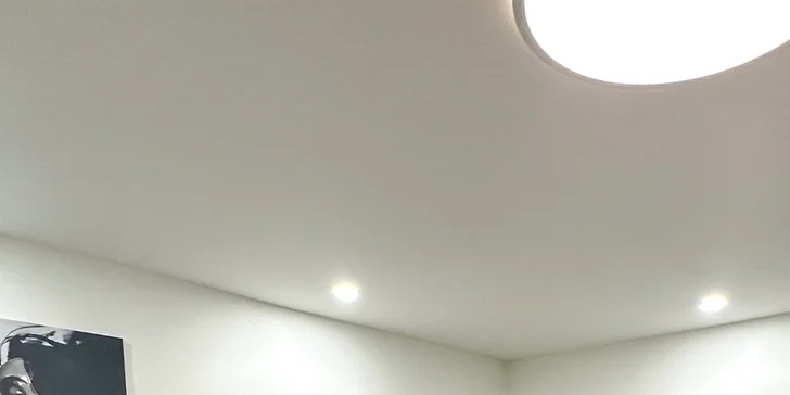 Plazmalift: horné alebo dolné viečka, vrásky okolo očí, celé čelo, nosoústna vráska