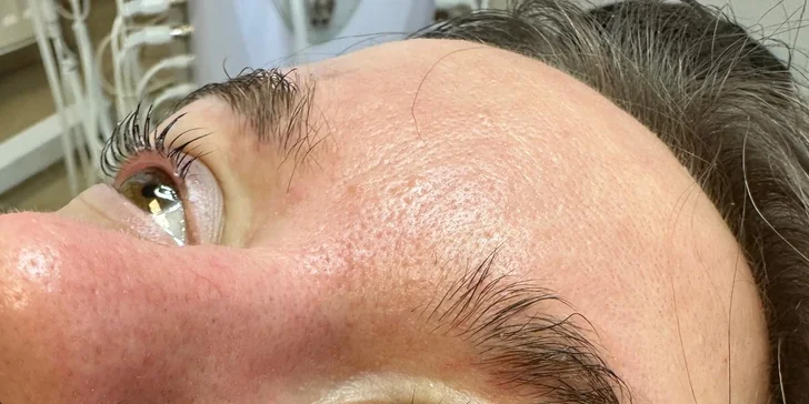 Cat & Fox Eyes riasy alebo kórejský lashlifting