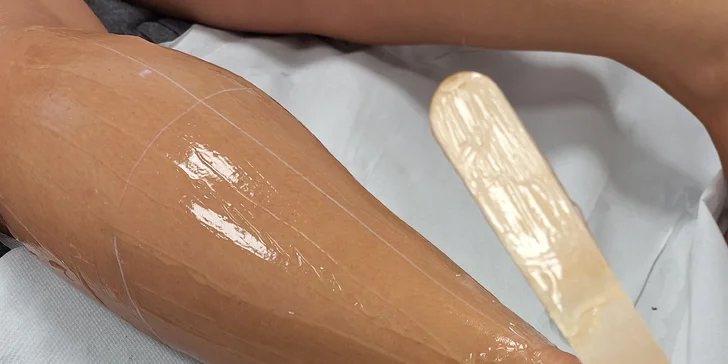 Laserová epilácia diódovým laserom pre ženy i mužov: horná pera, intímna zóna, predkolenie, podpazušie, ramená či hrudník