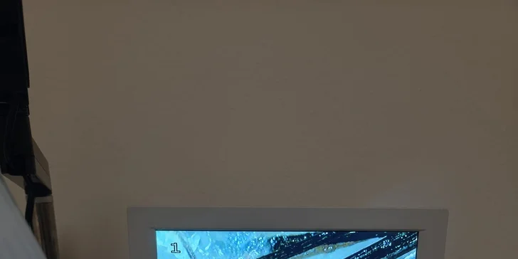 Brilliance Hair Therapy – laserová vlasová terapia novej generácie